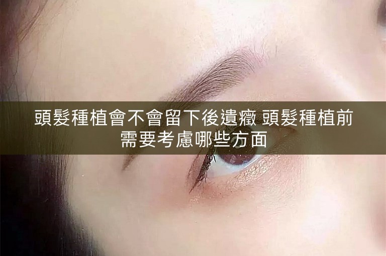 頭髮種植會不會留下後遺癥 頭髮種植前需要考慮哪些方面