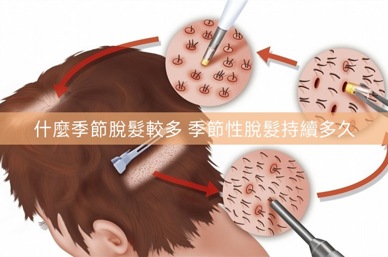 什麼季節脫髮較多 季節性脫髮持續多久