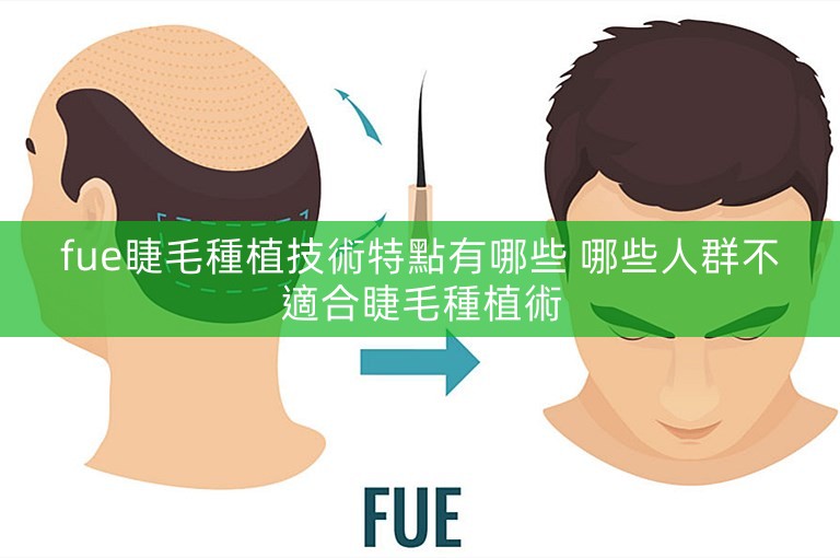 fue睫毛種植技術特點有哪些 哪些人群不適合睫毛種植術