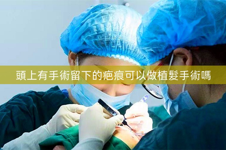 頭上有手術留下的疤痕可以做植髮手術嗎