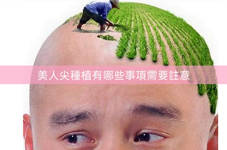 美人尖種植有哪些事項需要註意