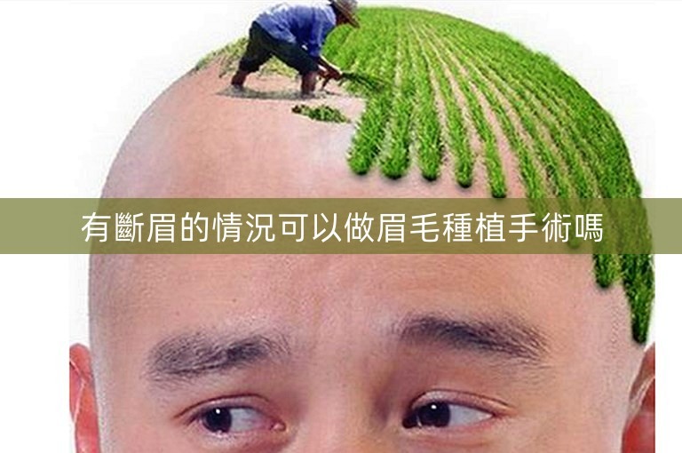 有斷眉的情況可以做眉毛種植手術嗎