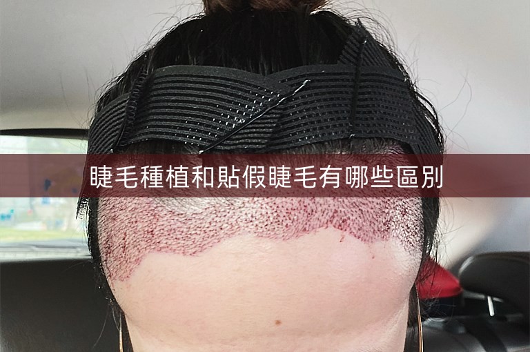 睫毛種植和貼假睫毛有哪些區別