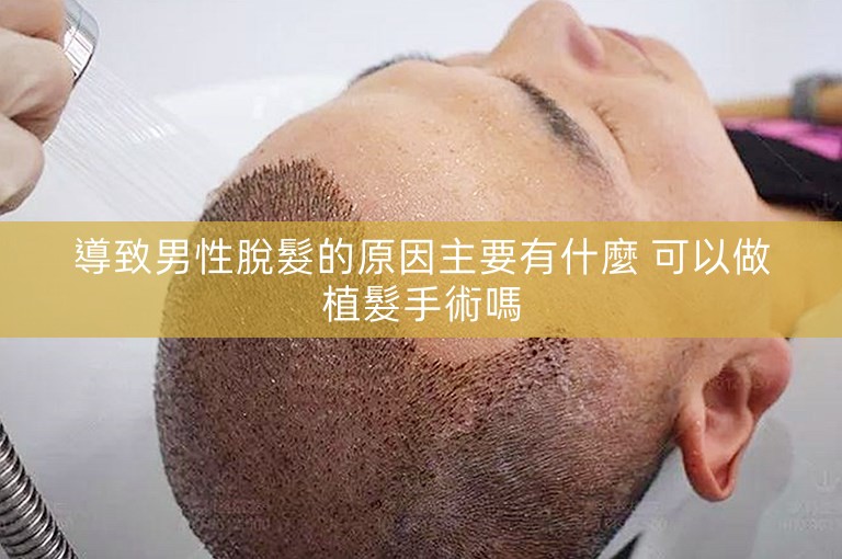 導致男性脫髮的原因主要有什麼 可以做植髮手術嗎