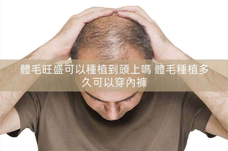 體毛旺盛可以種植到頭上嗎 體毛種植多久可以穿內褲