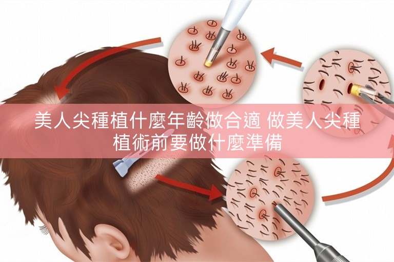 美人尖種植什麼年齡做合適 做美人尖種植術前要做什麼準備