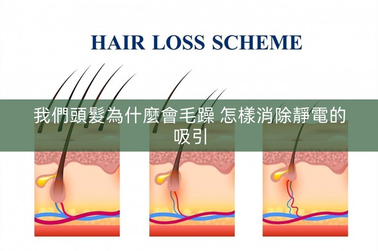 我們頭髮為什麼會毛躁 怎樣消除靜電的吸引