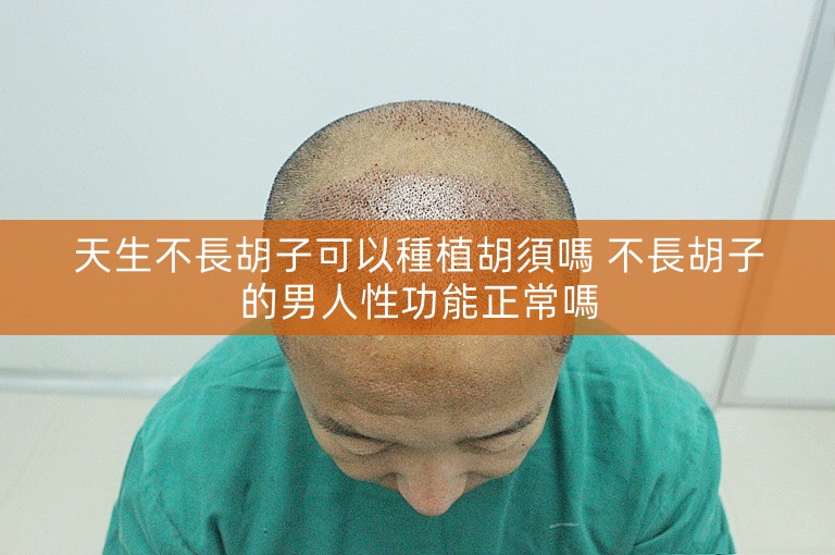 天生不長胡子可以種植胡須嗎 不長胡子的男人性功能正常嗎