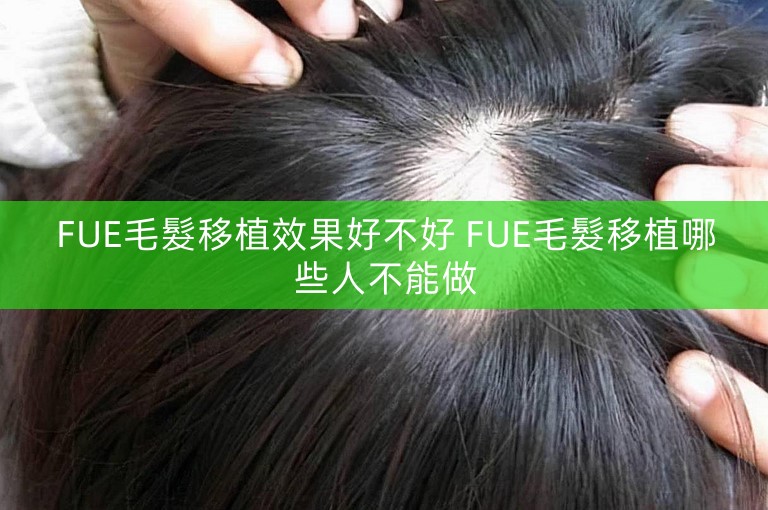 FUE毛髮移植效果好不好 FUE毛髮移植哪些人不能做